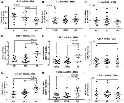 Studies on Colony Stimulating Factor Receptor-1 and Ligands Colony Stimulating Factor-1 and Interleukin-34 in Alzheimer's Disease Brains and Human Microglia